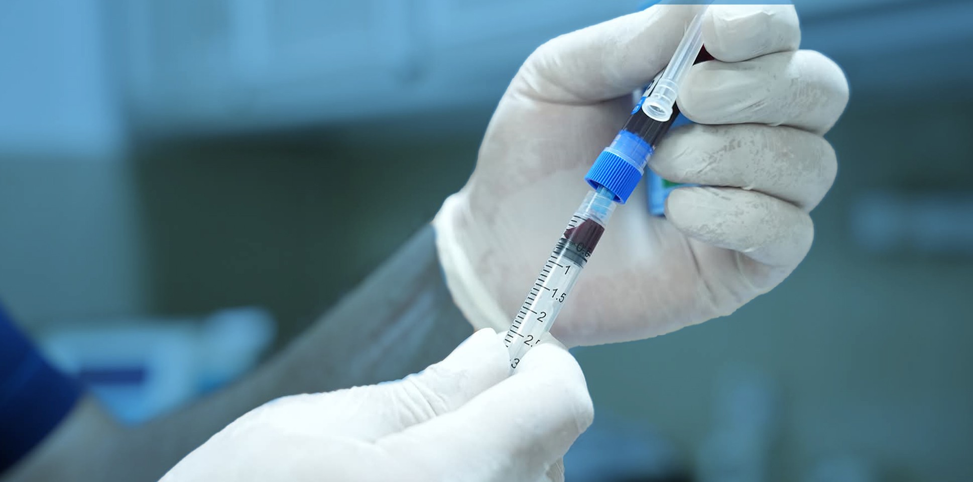 Sustaining Services of Expanded Program on Immunization EPI in the North of Syria
